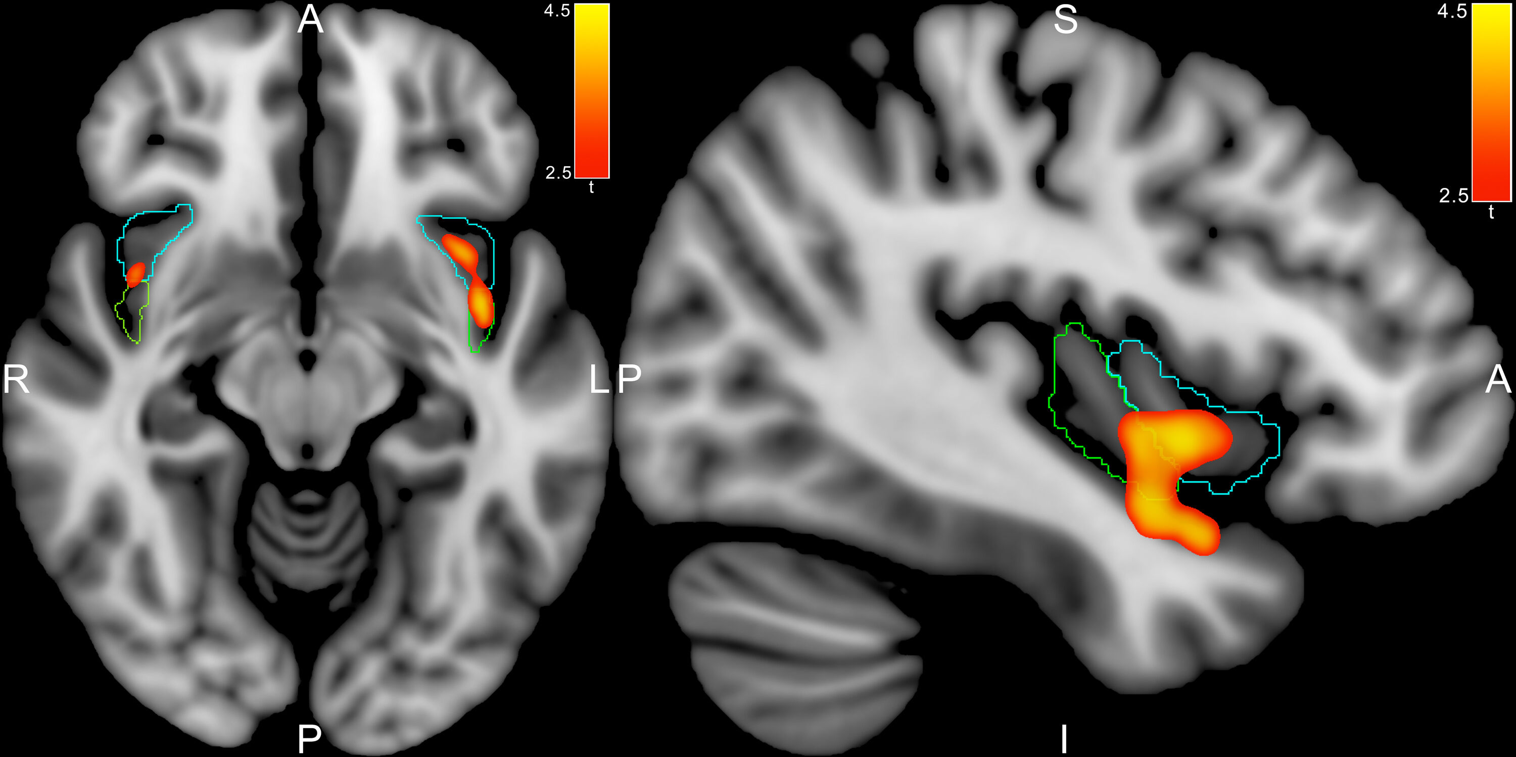 Source: Paper (Raufelder et al., 2021, Child Development)
