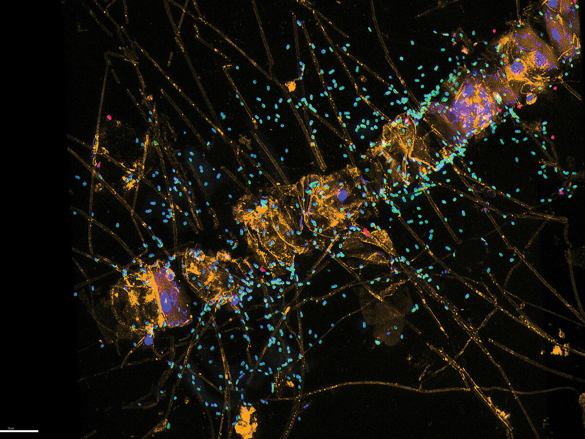 Polysaccharid-abbauende Bakterien (grün) an der Diatomee (Kieselalge) Chaetoceros sp. – Foto: I. Bakenhus / Max-Planck-Institut für Marine Mikrobiologie, Bremen