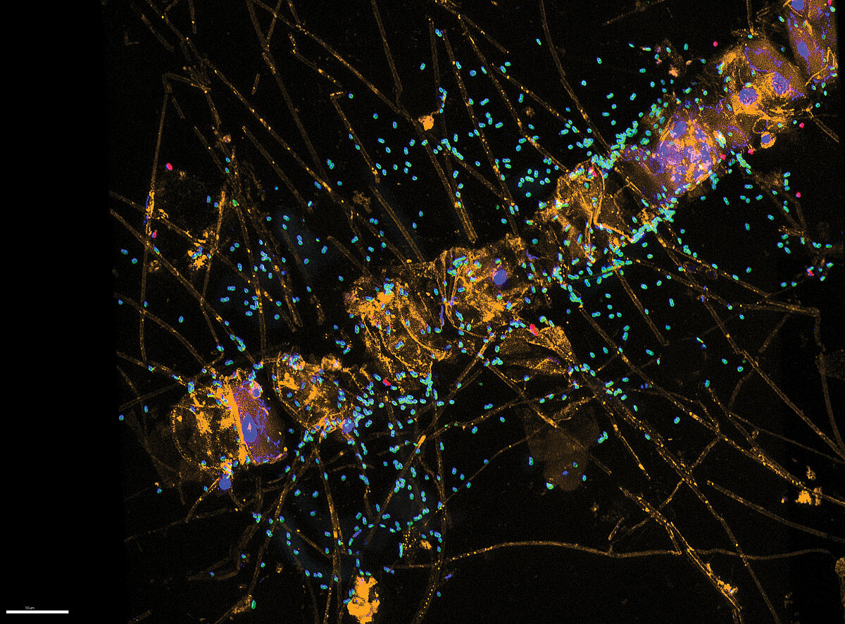 Polysaccharid-abbauende Bakterien (grün) an der Diatomee (Kieselalge) Chaetoceros sp. – Foto: I. Bakenhus / Max-Planck-Institut für Marine Mikrobiologie, Bremen